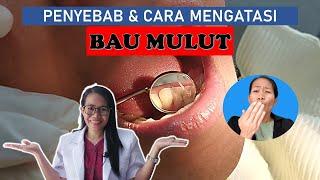 Penyebab dan cara mengatasi bau mulut