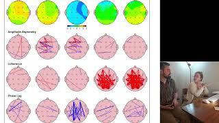 ️ What is a Brain Map? QEEG Brainmapping, Neurostimulation and NeuroFeedback for Trauma, ASD 