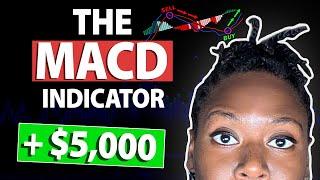 Understanding The MACD Indicator + MACD Trading Strategy