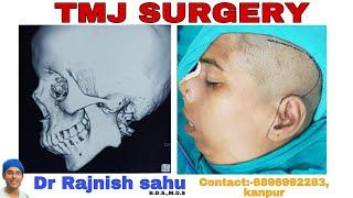 TMJ Surgery || TMJ ANKYLOSIS || @rajnishsahu82