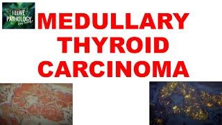 MEDULLARY THYROID CARCINOMA : Gross, Microscopic & Clinical features