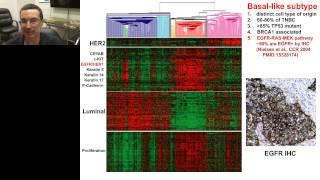 Charles Perou - Keynote Breast Cancer Genomics and Genetics