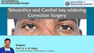 Telecanthus and Canthal bay widening Correction Surgery1
