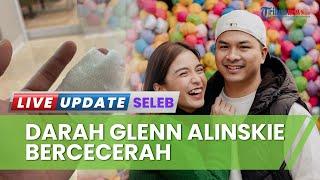 Glenn Alinskie Alami Musibah hingga Berucucuran Darah, Suami Chelsea Olivia Harus Terima 7 Jahitan