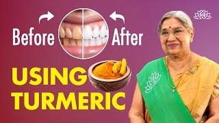 Teeth Whitening at Home| Ayurvedic Turmeric/Haldi Remedy for Brighter Teeth| Natural Oral Care Tips