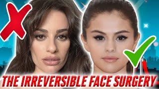 The Truth Behind Buccal Fat Removal FAILS vs. Successes: Using Celebrity Examples