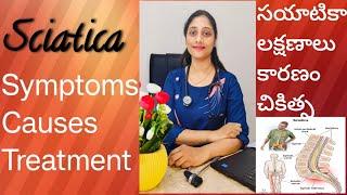 || Sciatica || Nerve impingement || causes || symptoms || Treatment || Dr.Moulika Pyla