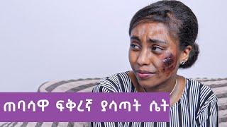 በፊቷ ጠባሳ ምክንያት ወንዶች የሚርቋት ሴት