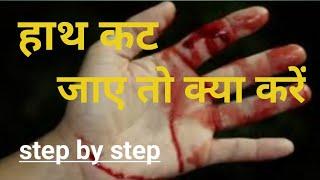 हाथ कट जाने पर क्या करें || what to do if hand got cut / injured