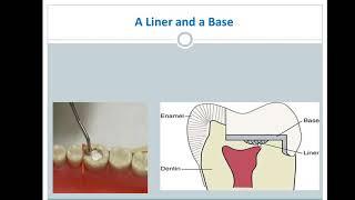 22-Uses of dental cements and examples for each(MJDF).