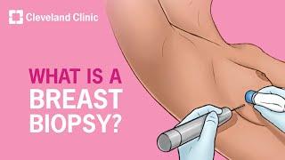 Breast Biopsy: Step-By-Step Explanation