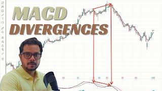 MACD Divergences