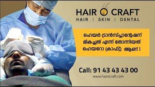 You will be Definitely Happy after Hair Transplant Surgery | Hair O Craft Success Story