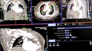 HOW TO DO FILMING OF CT-PA ( PULMONARY ANGIO) IN CT-SCAN. THIS VIDEO IS IN HINDI LANGUAGE.....