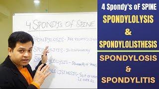 Spondylosis, Spondylolisthesis, Spondylitis, Spondylolysis- Cervical and Lumbar spondylosis