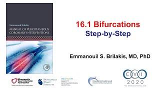 16.1 Bifurcation PCI step-by-step  - Manual of PCI