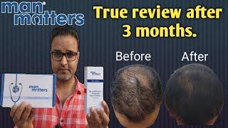 Man matters hair regrowth treatment 3 months honest review. #manmatters, #hair