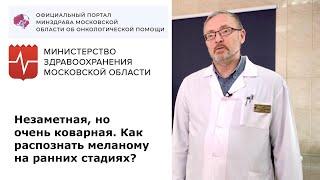 Незаметная, но очень коварная. Как распознать меланому на ранних стадиях?