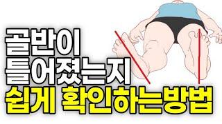 골반교정, 골반 자가진단 방법, 허리 통증이 있다면 꼭 확인해보세요!! 혼자 하는 골반교정 운동