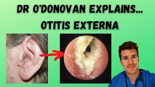 Explaining Otitis Externa | With Dr O'Donovan