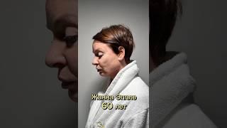 Жанна Эппле до/после невидимой подтяжки лица!  #сергейсвиридов