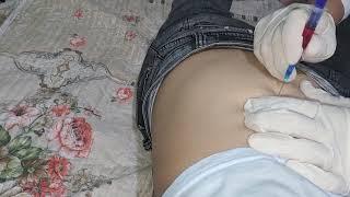 intramuscular injection b12, into the gluteal muscle. intramuscular injection 