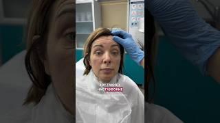 Как вам результат? Коронарная подтяжка лба. Нижняя блефаропластика. НИКОЛАЕВА САНДАРА АФАНАСЬЕВНА