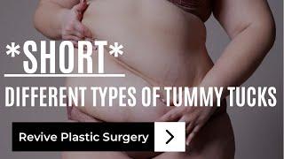 Different Types of Tummy Tucks