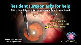 CataractCoach™ 2119: resident surgeon asks for help