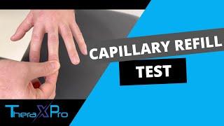 Capillary Refill Test | Peripheral Tissue Blood Flow
