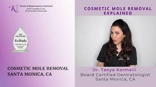 Cosmetic Mole Removal Treatment in Santa Monica, Cosmetic Mole Removal in Santa Monica, Dermatologis