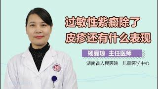 过敏性紫癜除了皮疹还有什么表现 有来医生