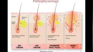 Derma 1 ACNE By Rph.Ahmed Reda