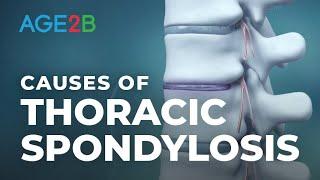 What Causes Thoracic Spondylosis? | Mid-Back Or Thoracic Pain | Thoracic Spine Pain