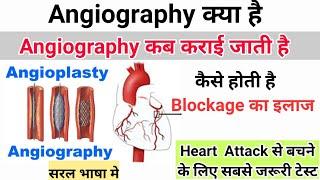 Angiography ओर Angioplasty क्या है || किसे करानी चाहिए || एंजियोग्राफी कैसे होती है