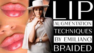 Lip augmentation technique by Emelyan Braude - my transcript
