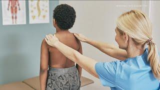 Scoliosis in kids | Why are doctors seeing more cases?