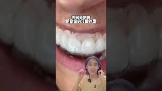 牙套維持器可以當美白牙托使用嗎#牙齒矯正#牙齒美白