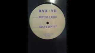 Dentist vs Edge - XVX Records