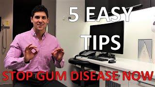 HOW TO STOP GUM DISEASE AND BLEEDING AT HOME (Fix Gingivitis And Gum Pain, 5 Simple Steps)