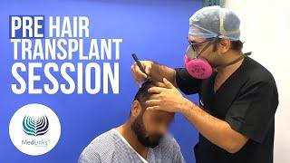 How Pre Hair Transplant Preparation is done? - at MedLinks Hair Transplant, Delhi