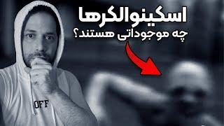 آیا اسکینوالکرها واقعا وجود دارند؟  واقعی - ترسناک