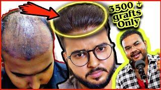 3500+GRAFTS में क्या 6TH GRADE का HIGH DENSITY में HAIR TRANSPLANT POSSIBLE है || समझिए इस VIDEO से