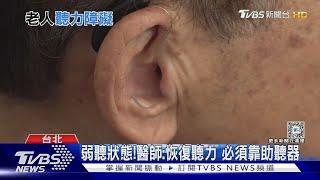 聽覺退化兇手是...「這問題」醫師:弱聽原因與老化離不了關係...｜十點不一樣20240319@TVBSNEWS01