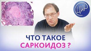 Саркоидоз. Что такое саркоидоз, предрасположенность к саркоидозу. Саркоидоз и проблемы репродукции.