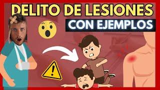  DELITO de LESIONES ¿Qué es? ¿Tipos? [DESCUBRE TODO en MATERIA PENAL con EJEMPLOS]