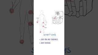 Osteoarthritis EXPLAINED #jointpain #arthritis #healthsketch