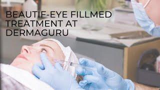 Fillmed 'BEAUTIF-EYE' treatment at DermaGuru | Nanosoft needle *ZERO PAIN*