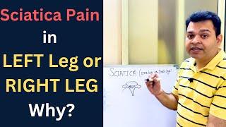 Sciatica, Pain in One leg or Both Legs, Disc Bulge, Lumbar canal Stenosis,  Nerve Compression in Leg