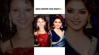 When Surgery Goes Right for Bollywood Actresses  #BollywoodBeauty #GlowUp #Transformation